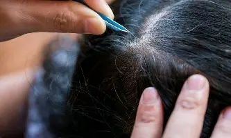 Nhổ tóc bạc