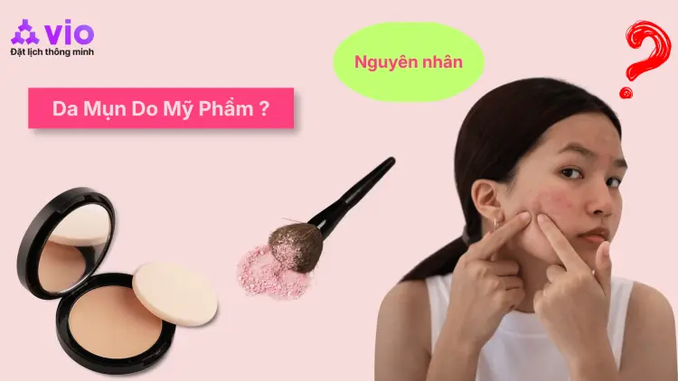 Da Mụn Không Chỉ Do Mỹ Phẩm: 5 Nguyên Nhân Thường Bị Bỏ Qua
