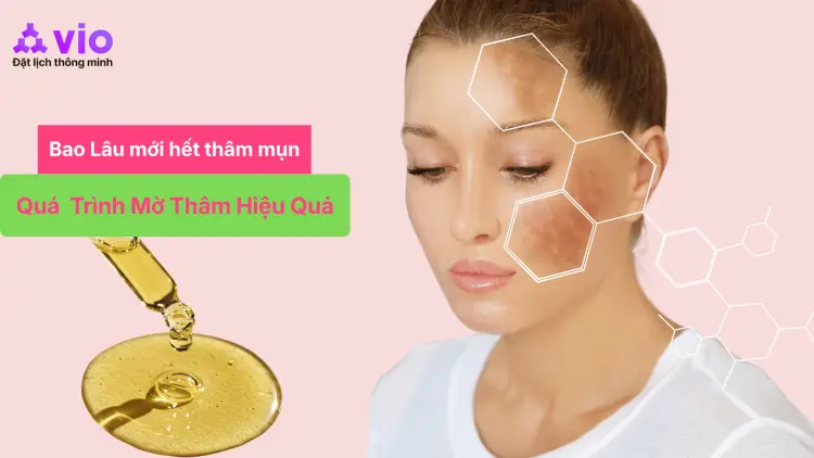 Thâm Mụn Bao Lâu Mới Hết? Sự Thật Về Quá Trình Mờ Thâm Mà Nhiều Người Chưa Biết